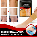 🌿 Pack 36 Patches para o Cuidado das Veias – Alívio Natural e Conforto Diário
